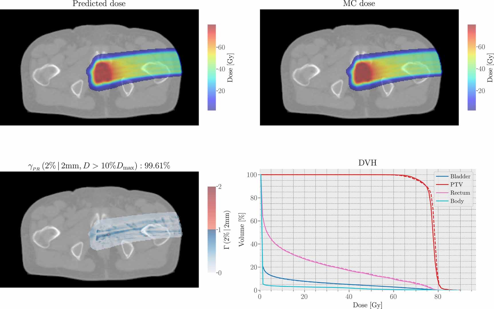 Proton dose calculation with LSTM networks in presence of a magnetic ...