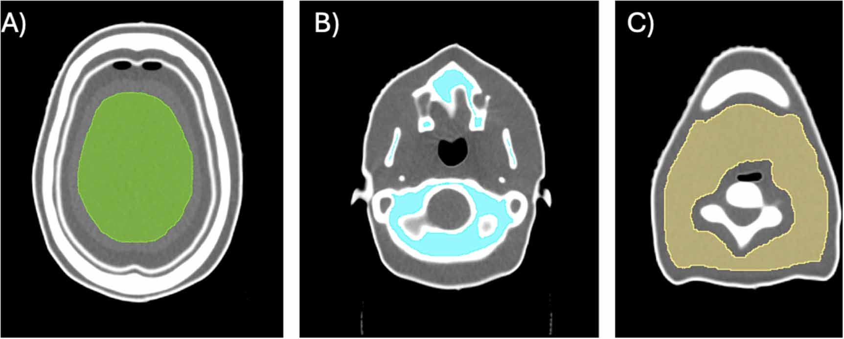 Optimisation of cone beam CT radiotherapy imaging protocols using a ...