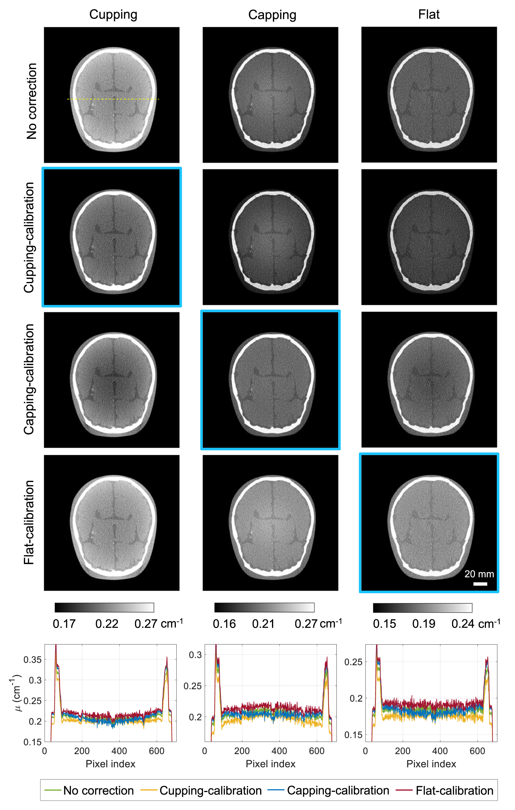 Study on the impact of bowtie filter on photon-counting CT imaging ...