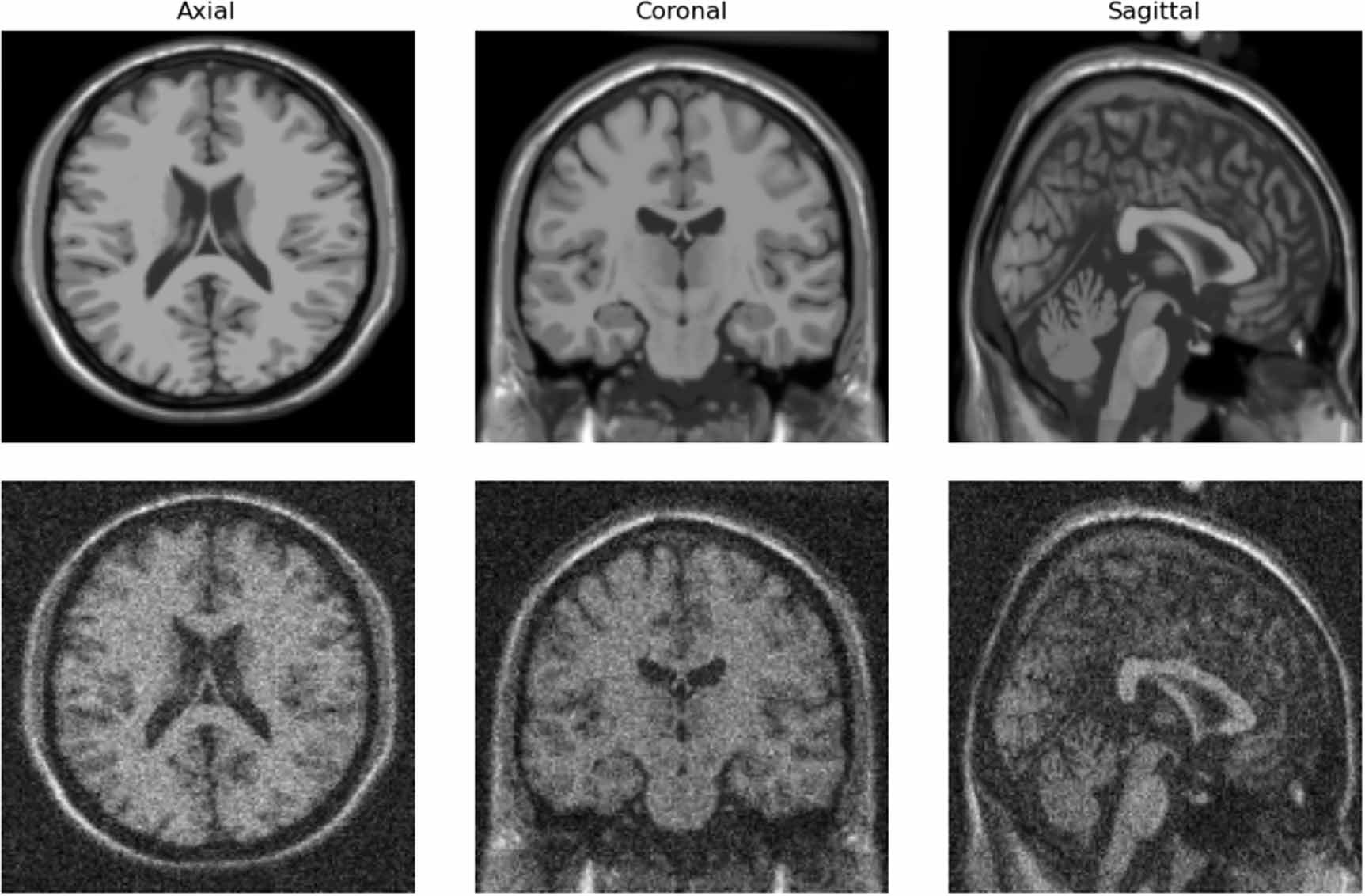 Deep learning methods for 3D magnetic resonance image denoising, bias ...
