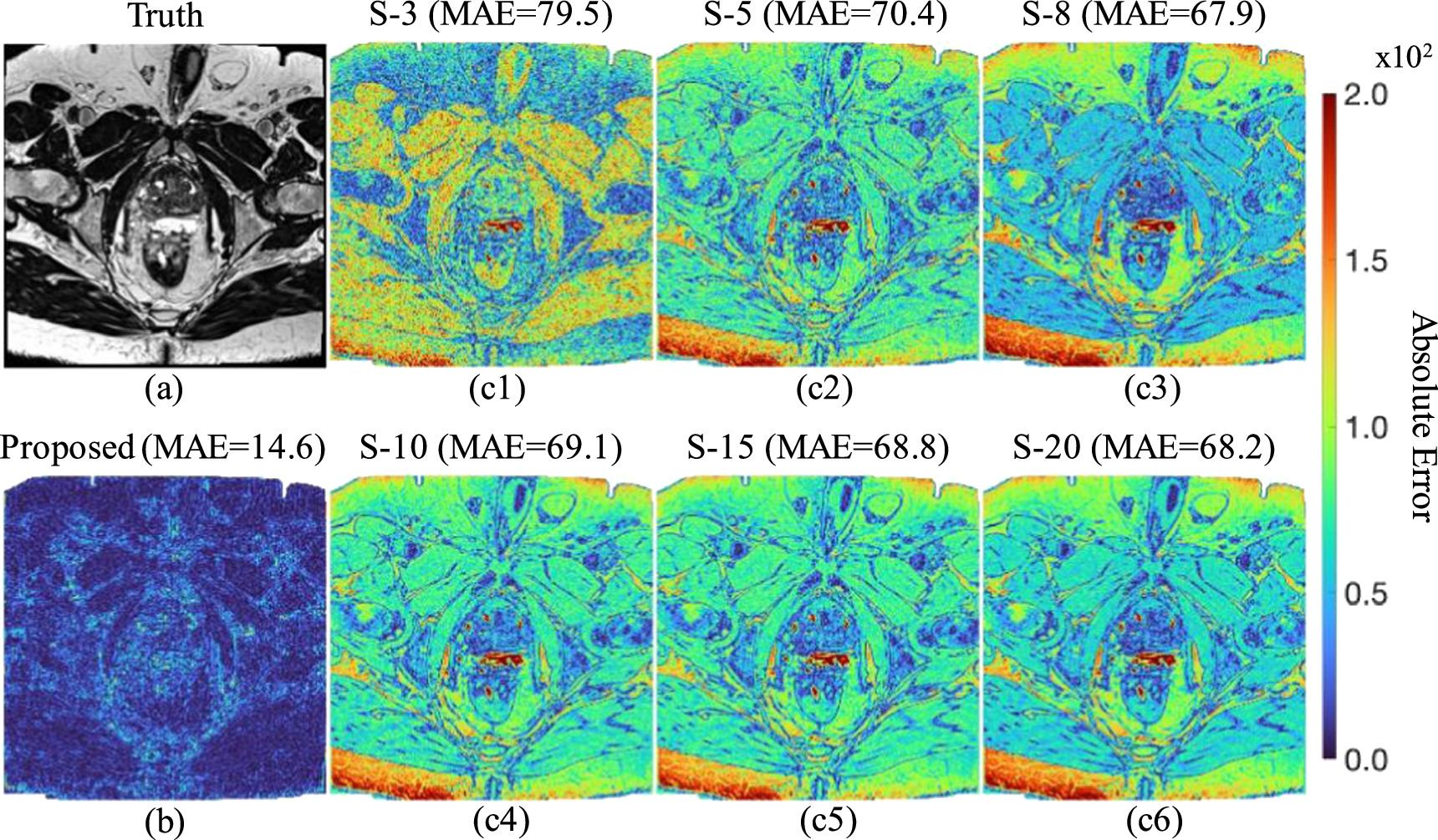 High-resolution MRI synthesis using a data-driven framework with ...