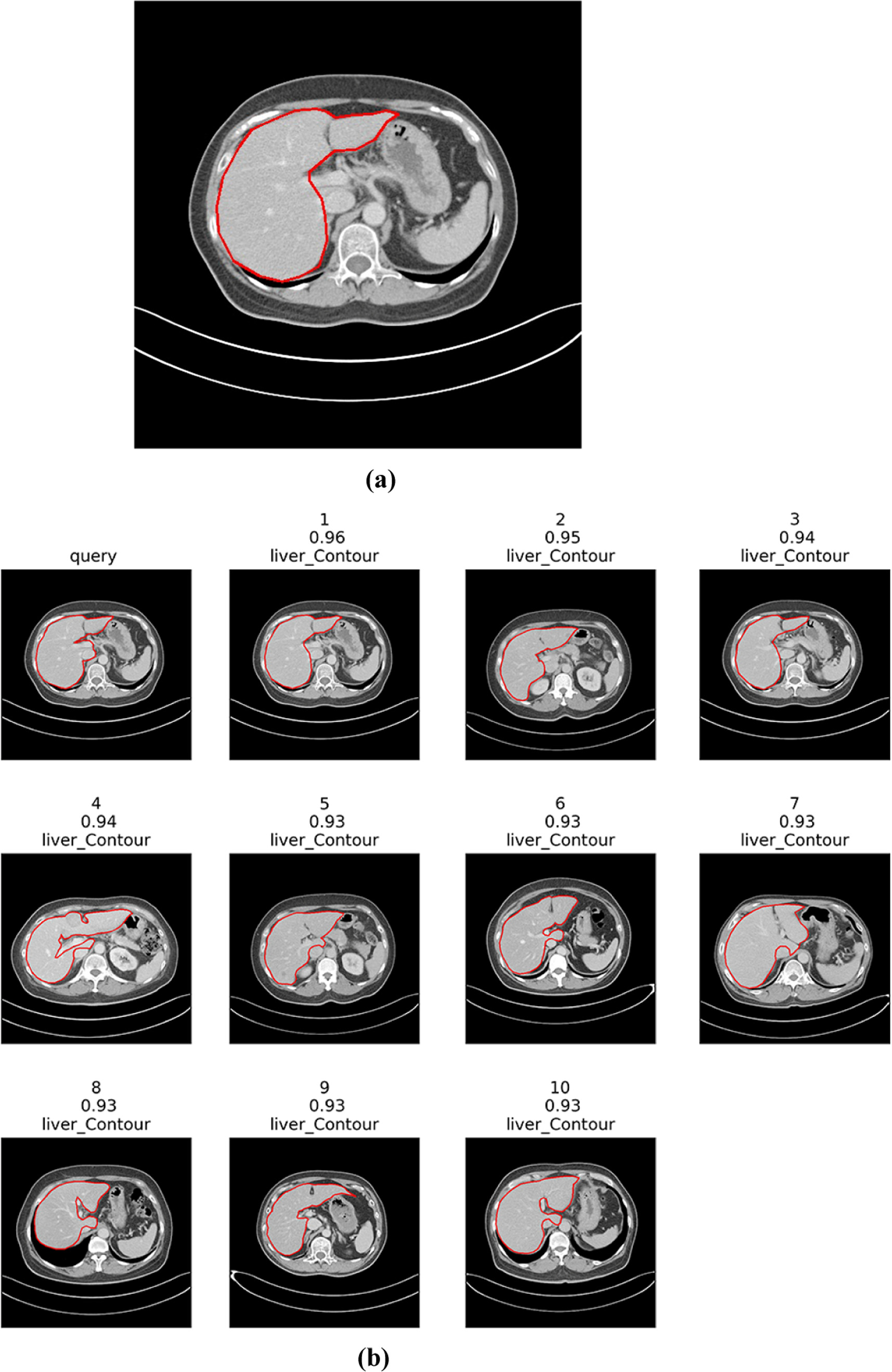 Interactive content-based image retrieval with deep learning for CT ...