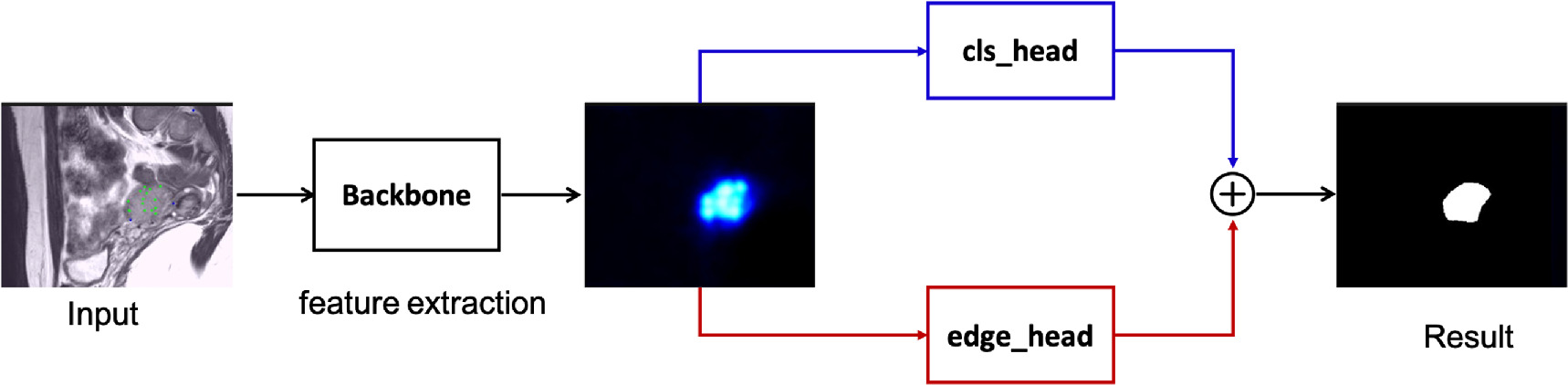 Interactive segmentation of medical images using deep learning - IOPscience