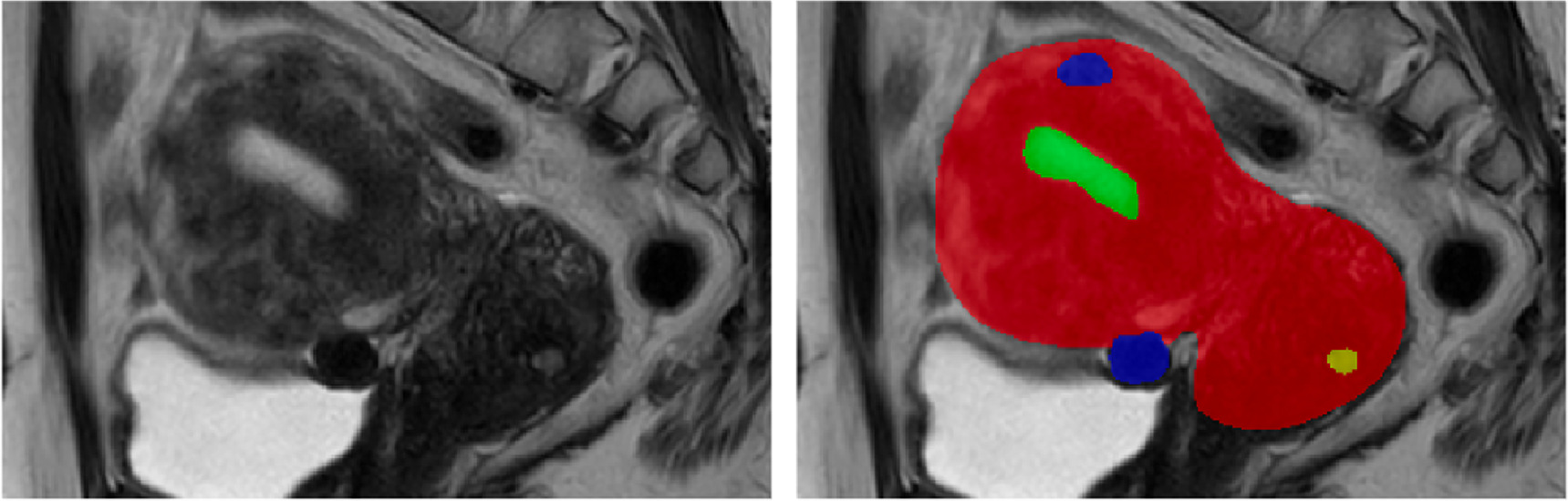 Huggingface Medical Segmentation Interactive segmentation of medical images using deep learning - IOPscience