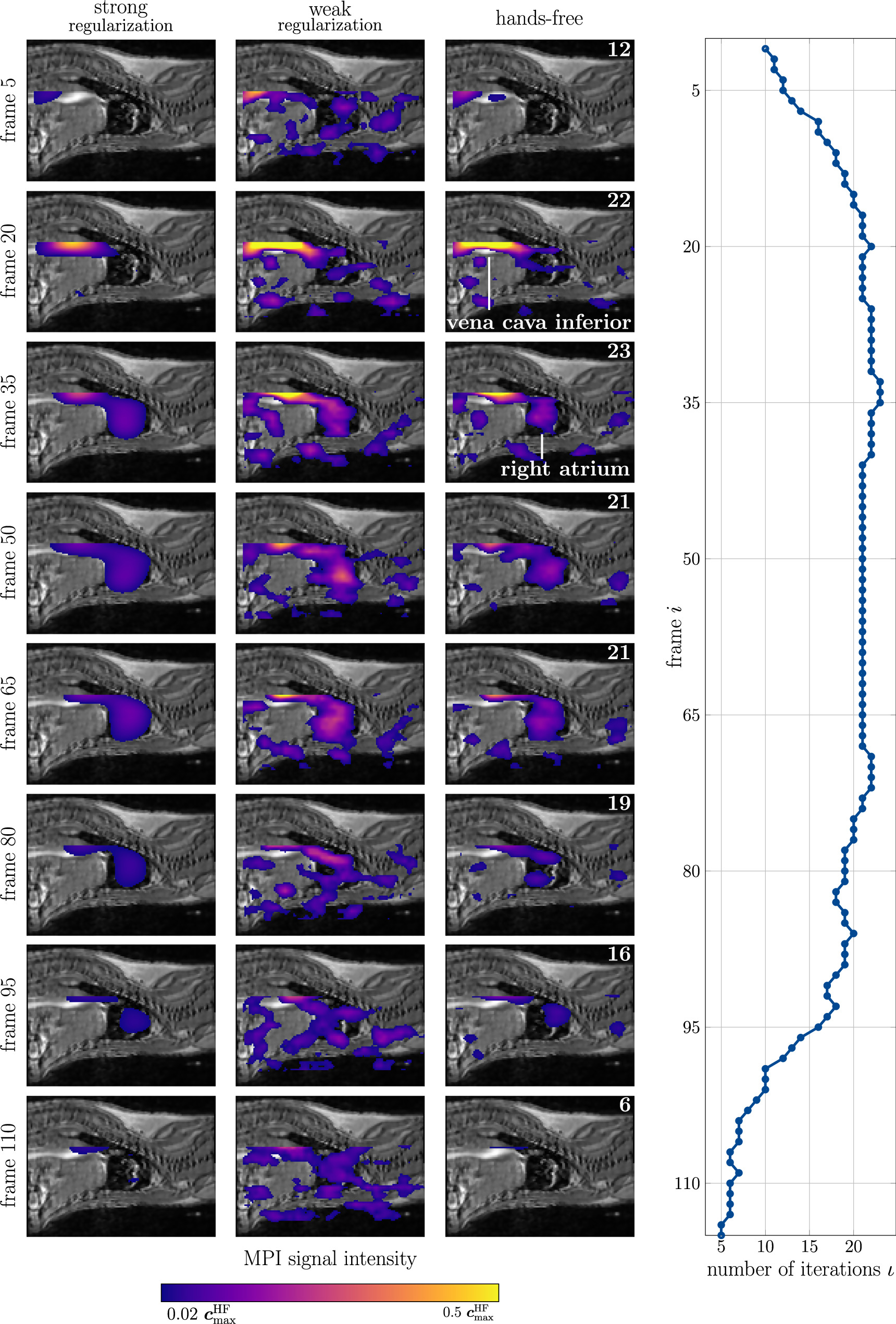 Solving the MPI reconstruction problem with automatically tuned ...