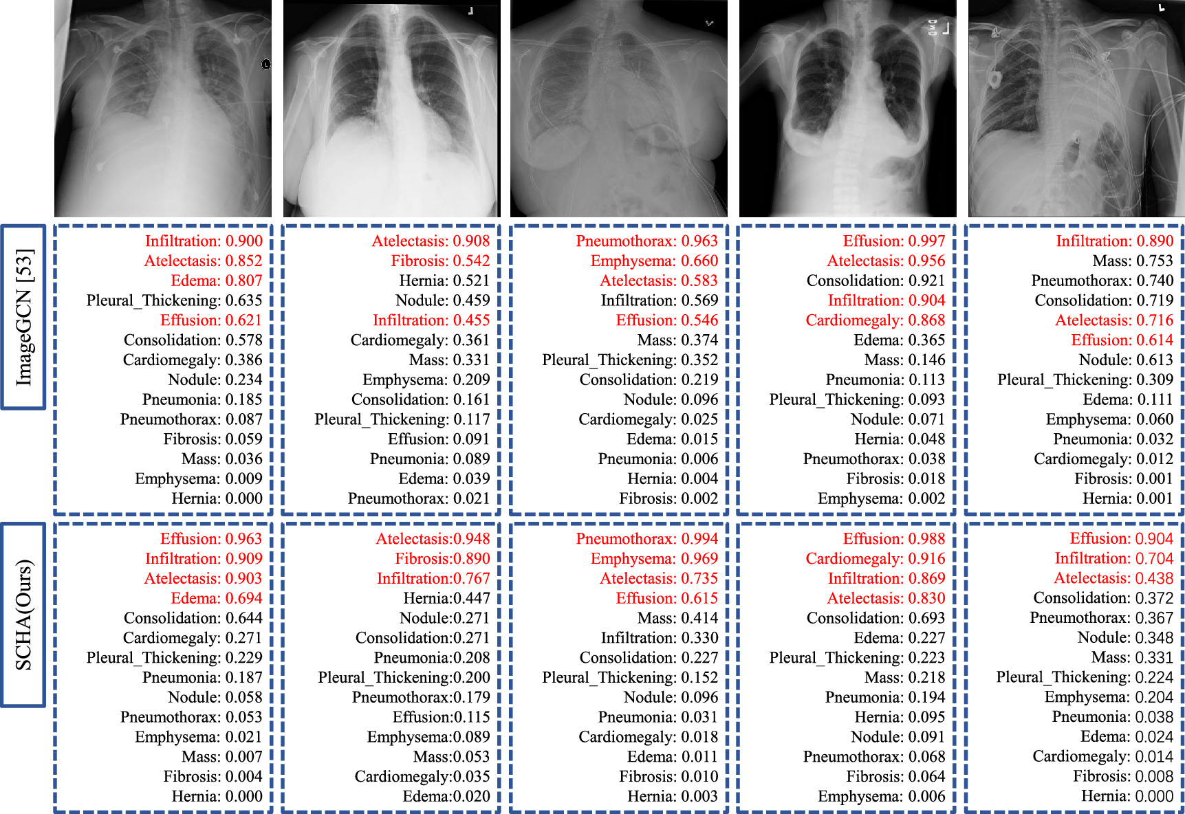 Chest x-ray diagnosis via spatial-channel high-order attention ...