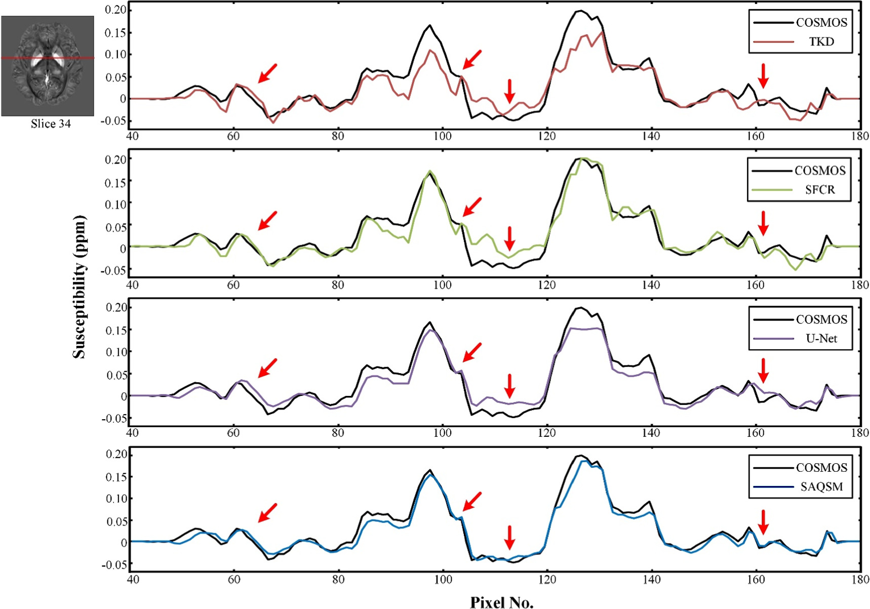 A spatially adaptive regularization based three-dimensional ...