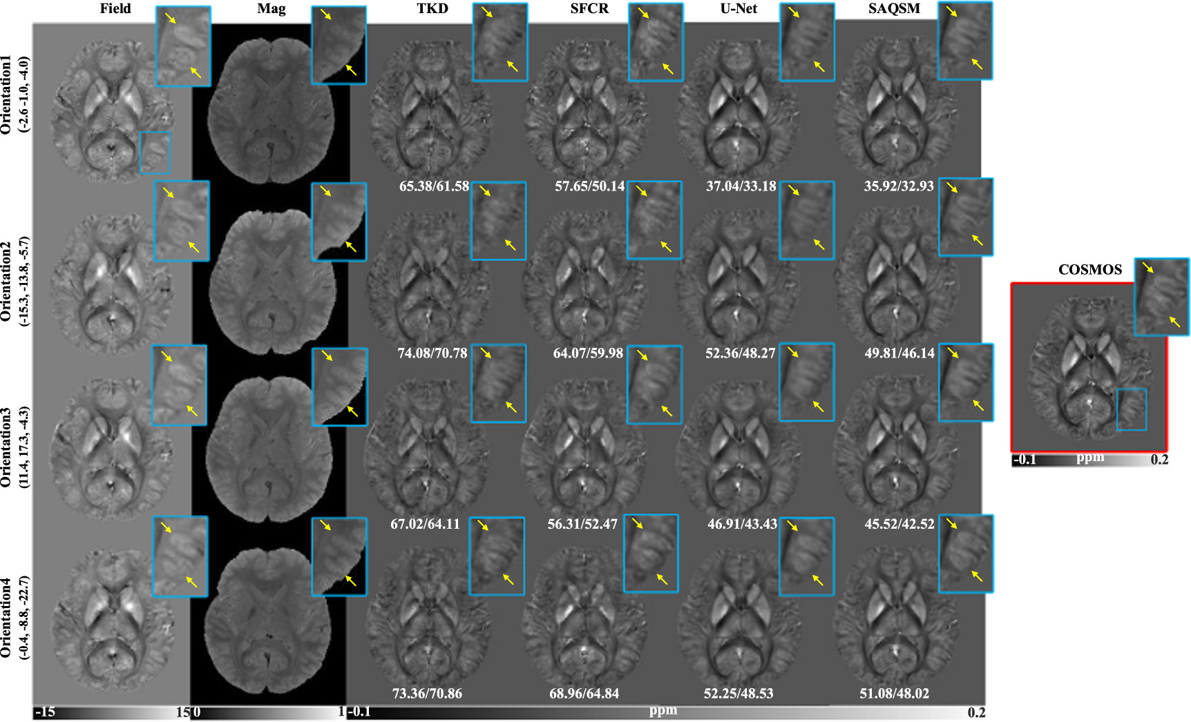 A spatially adaptive regularization based three-dimensional ...