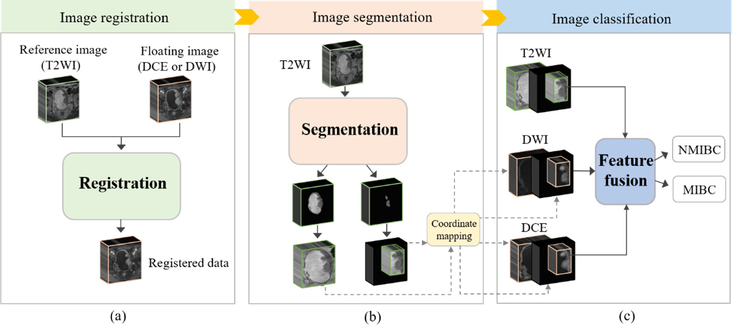 A novel predict method for muscular invasion of bladder cancer based on ...