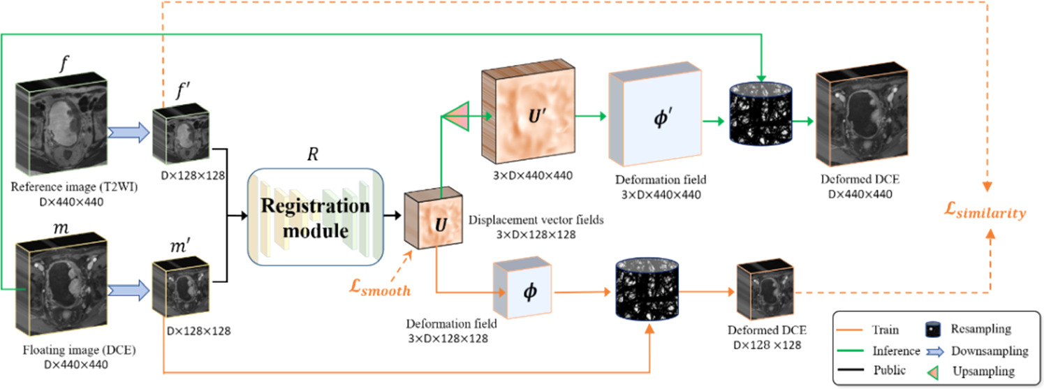 A novel predict method for muscular invasion of bladder cancer based on ...