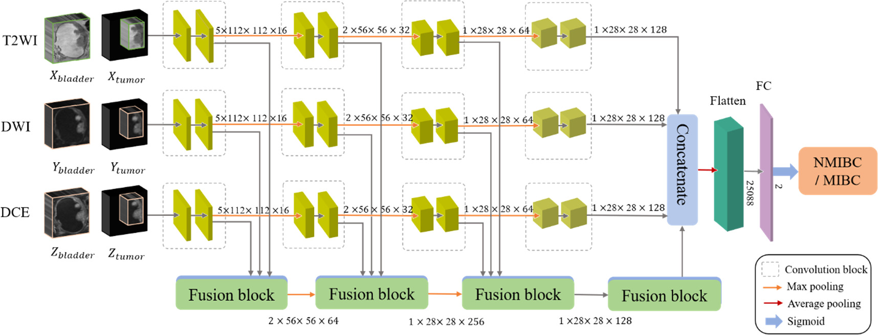 A novel predict method for muscular invasion of bladder cancer based on ...