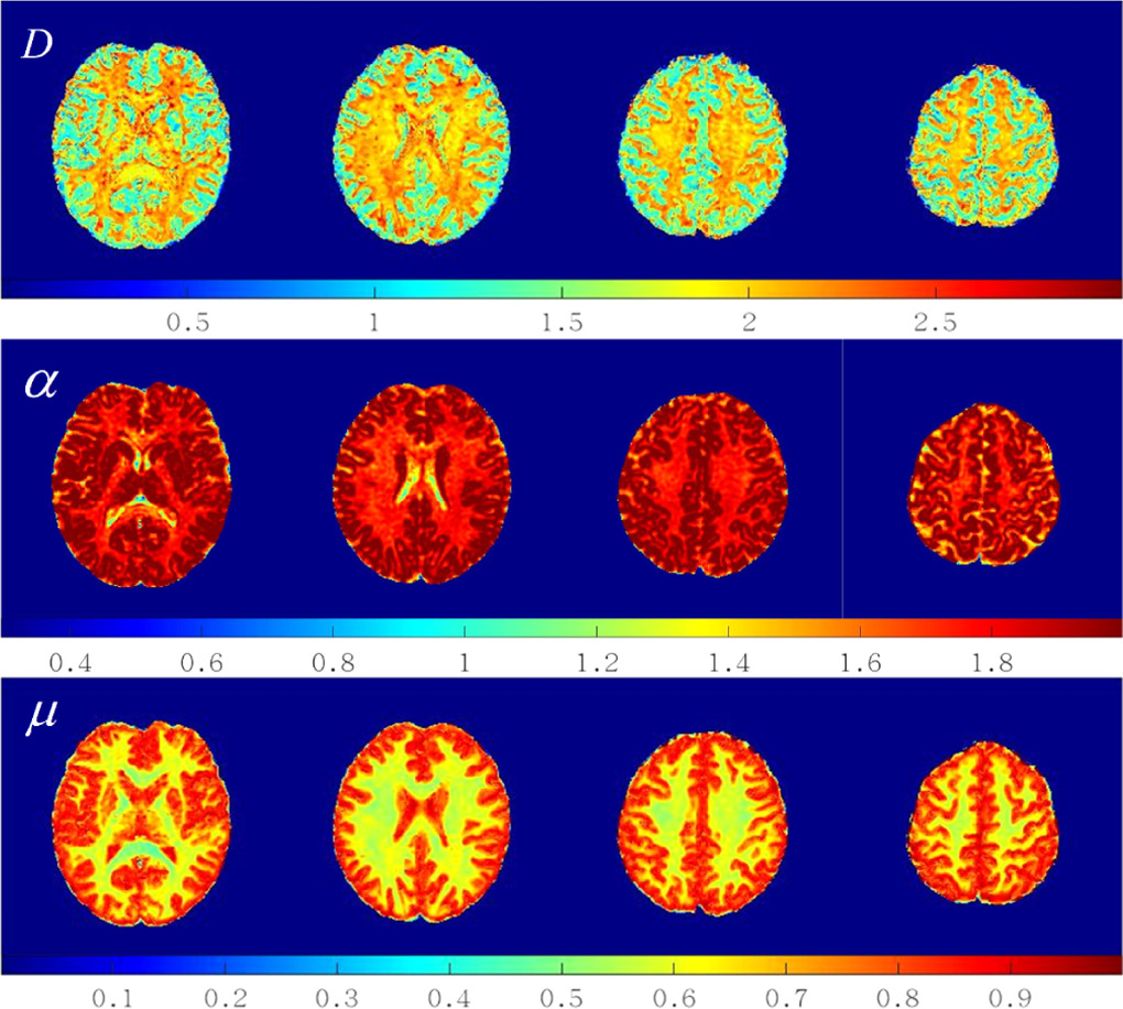Superficial white matter microstructural imaging method based on time ...