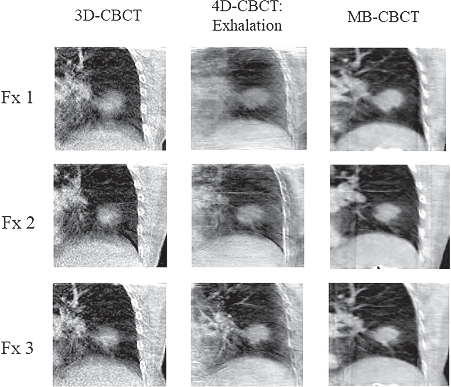 Motion compensated cone-beam CT reconstruction using an a priori motion ...