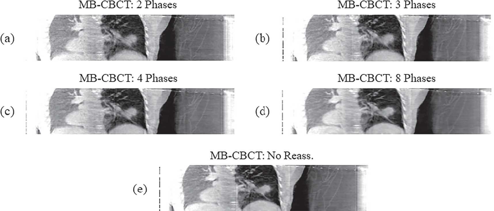 Motion compensated cone-beam CT reconstruction using an a priori motion ...