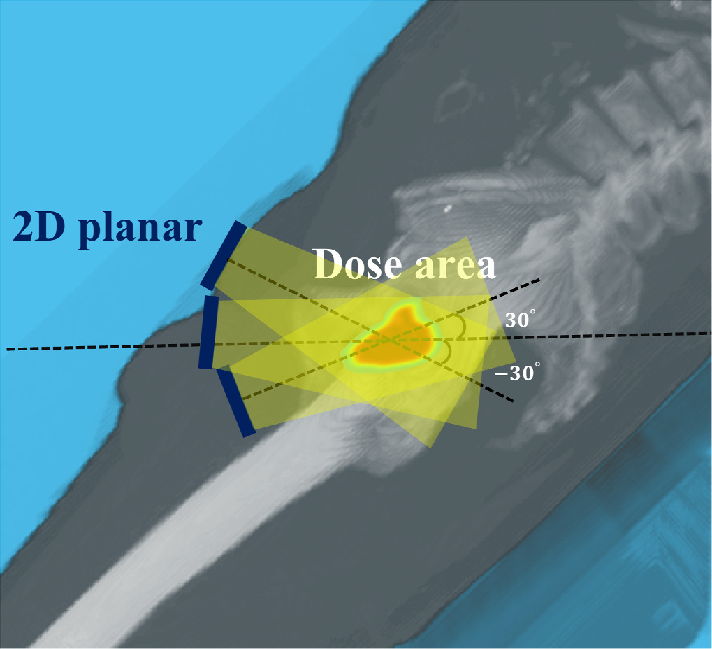 Hybrid-supervised deep learning for domain transfer 3D protoacoustic ...
