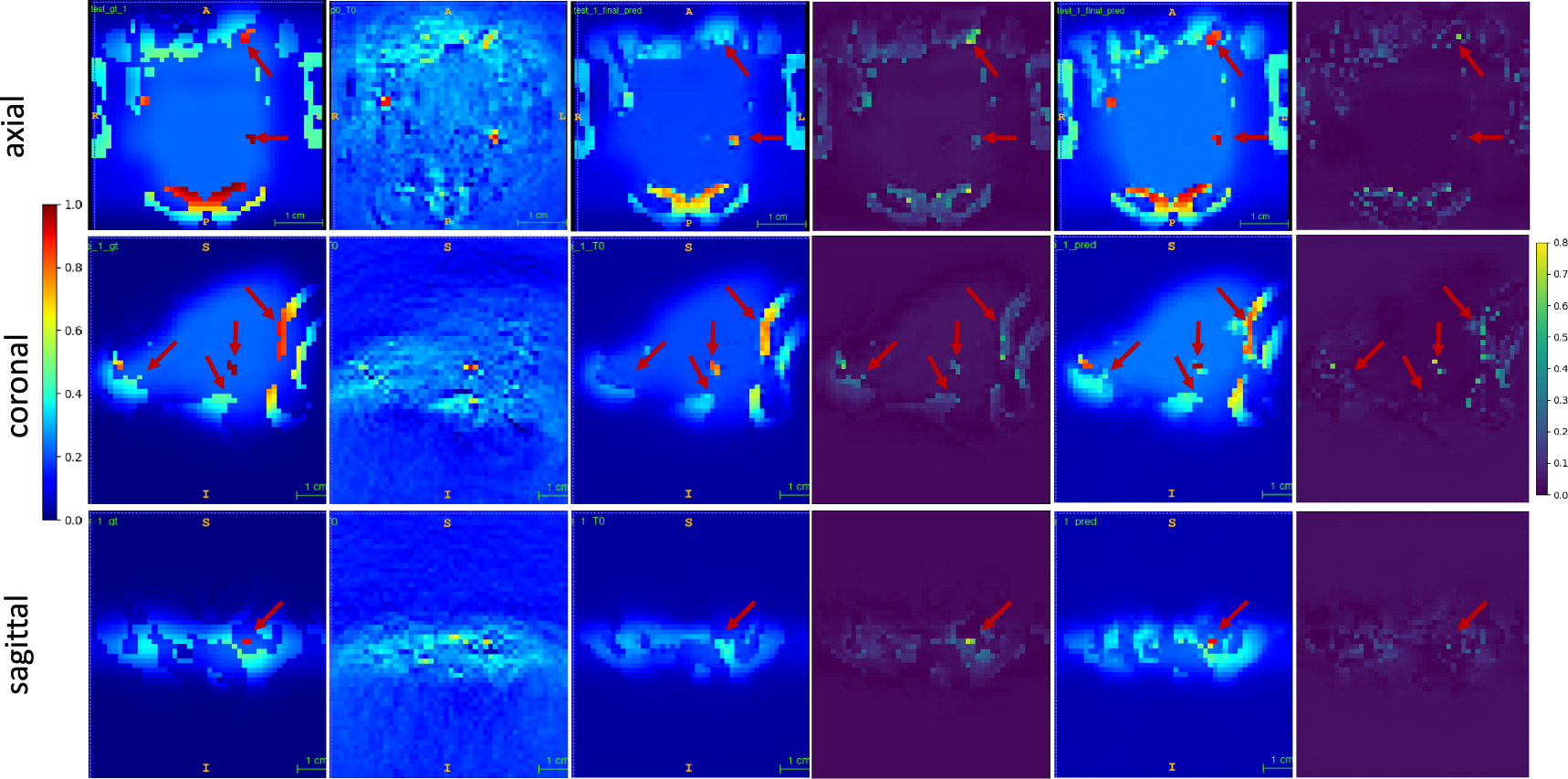 Hybrid-supervised deep learning for domain transfer 3D protoacoustic ...