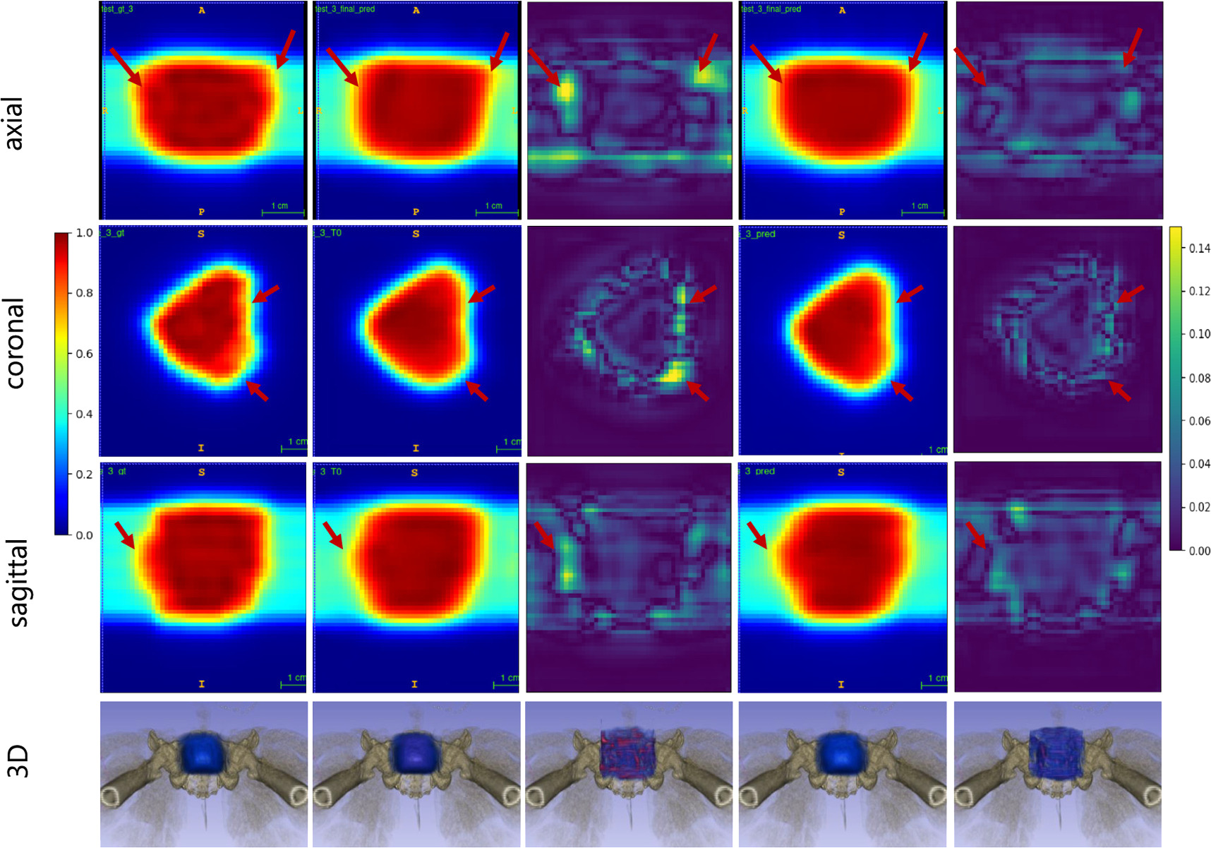 Hybrid-supervised deep learning for domain transfer 3D protoacoustic ...