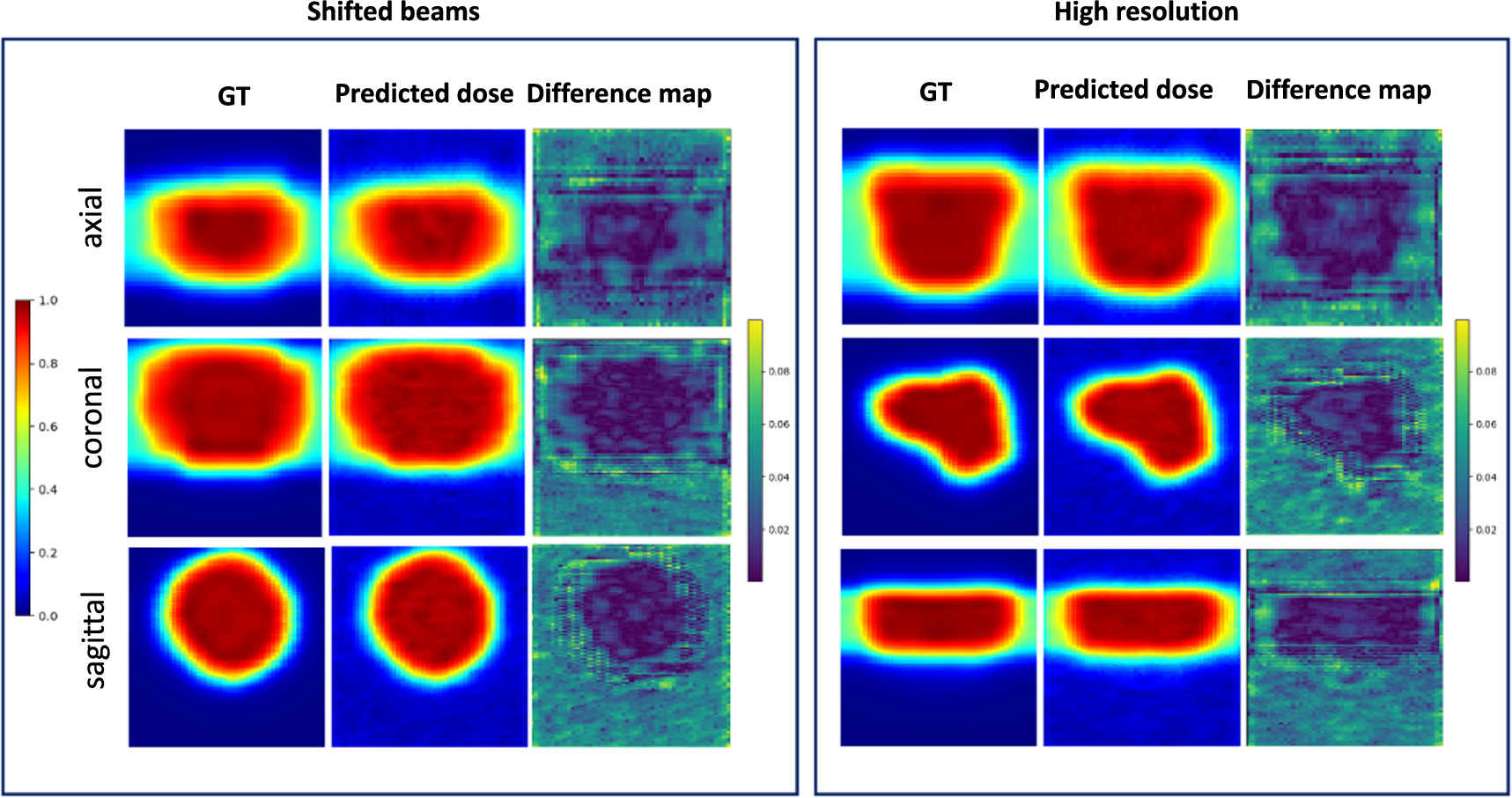Hybrid-supervised deep learning for domain transfer 3D protoacoustic ...