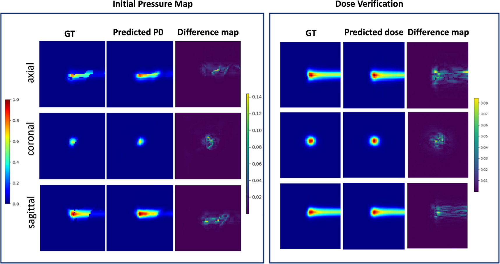 Hybrid-supervised deep learning for domain transfer 3D protoacoustic ...