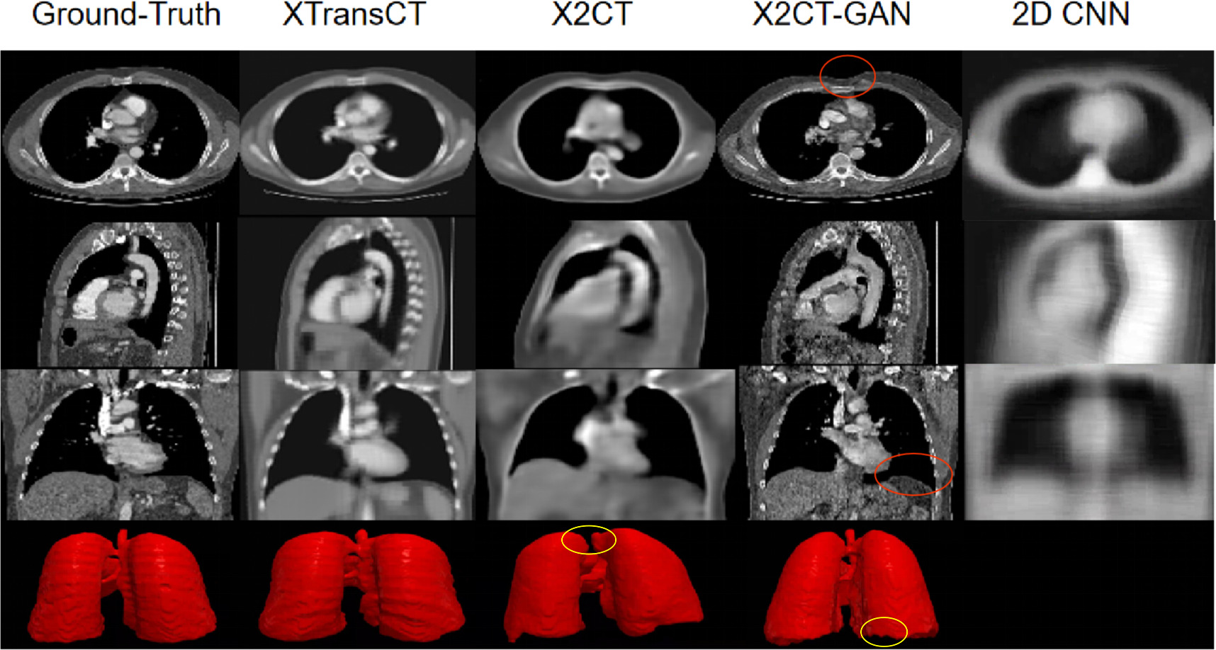 XTransCT: ultra-fast volumetric CT reconstruction using two orthogonal ...