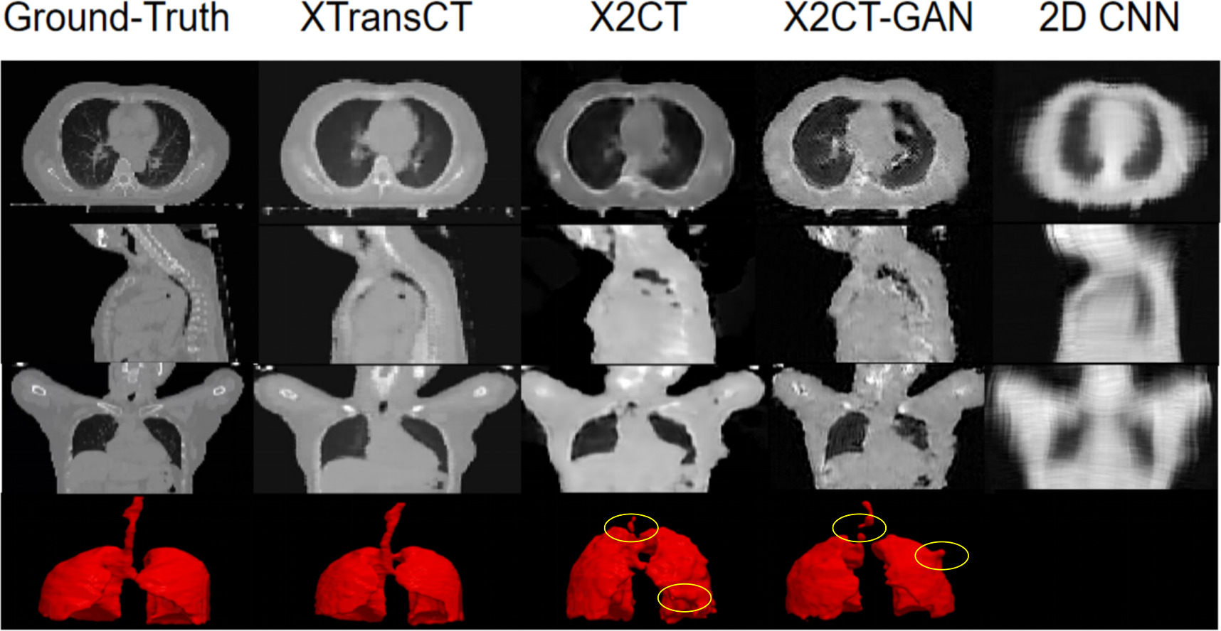 XTransCT: ultra-fast volumetric CT reconstruction using two orthogonal ...
