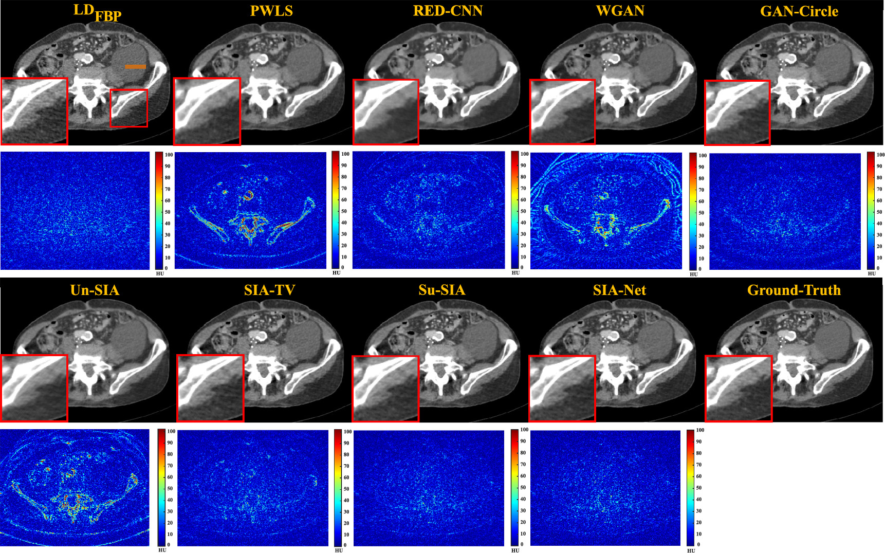 Snivogram Semi-supervised iterative adaptive network for low-dose CT sinogram ...