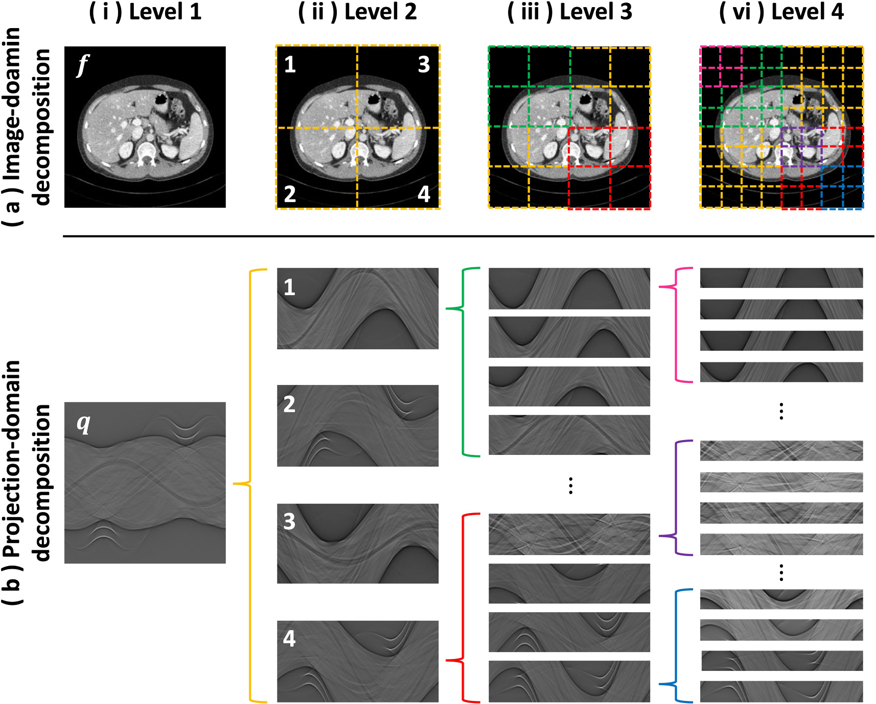 Hierarchical decomposed dual-domain deep learning for sparse-view CT ...