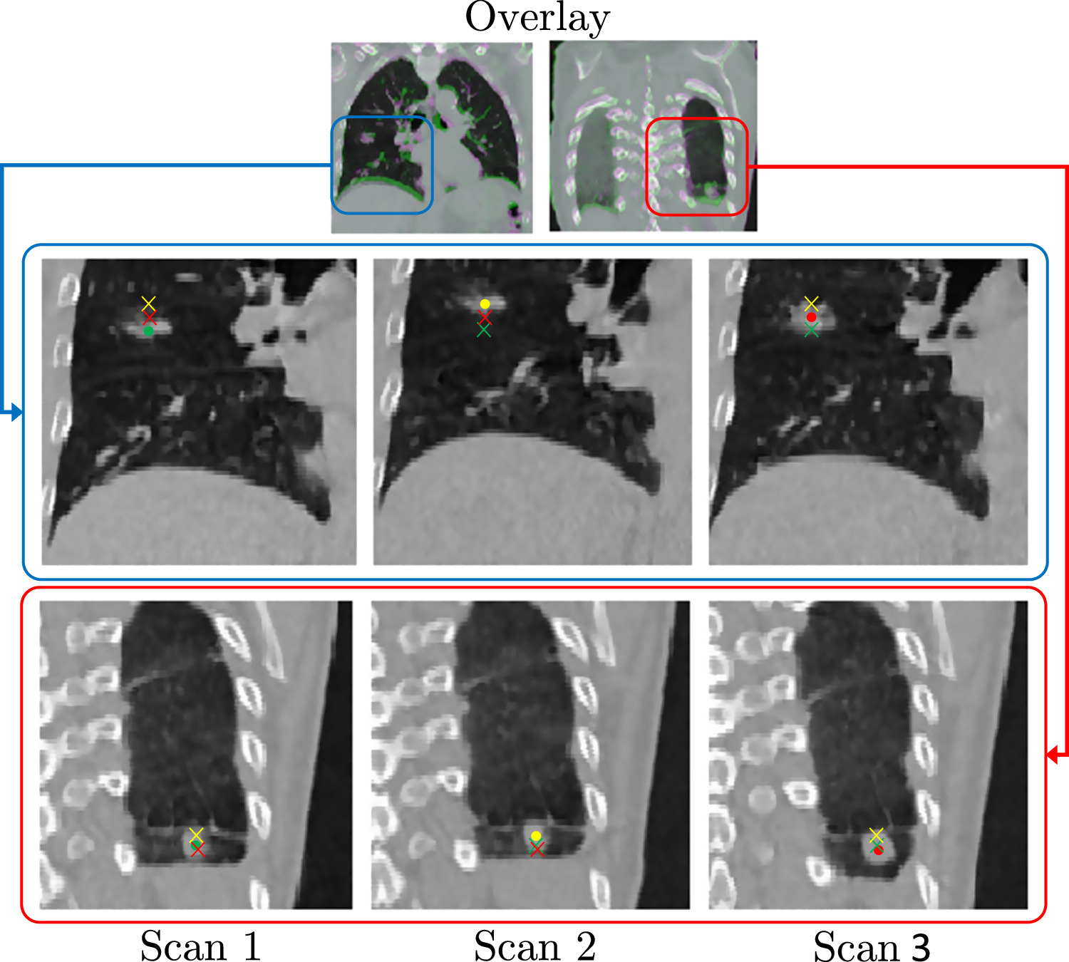 CT respiratory motion synthesis using joint supervised and adversarial ...