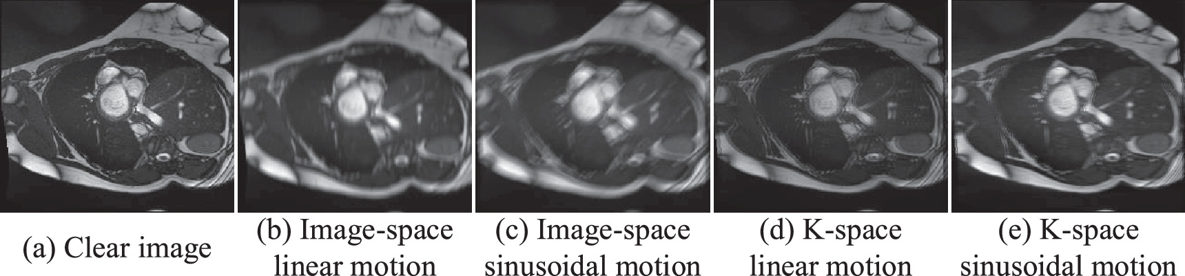 A cardiac MRI motion artifact reduction method based on edge ...