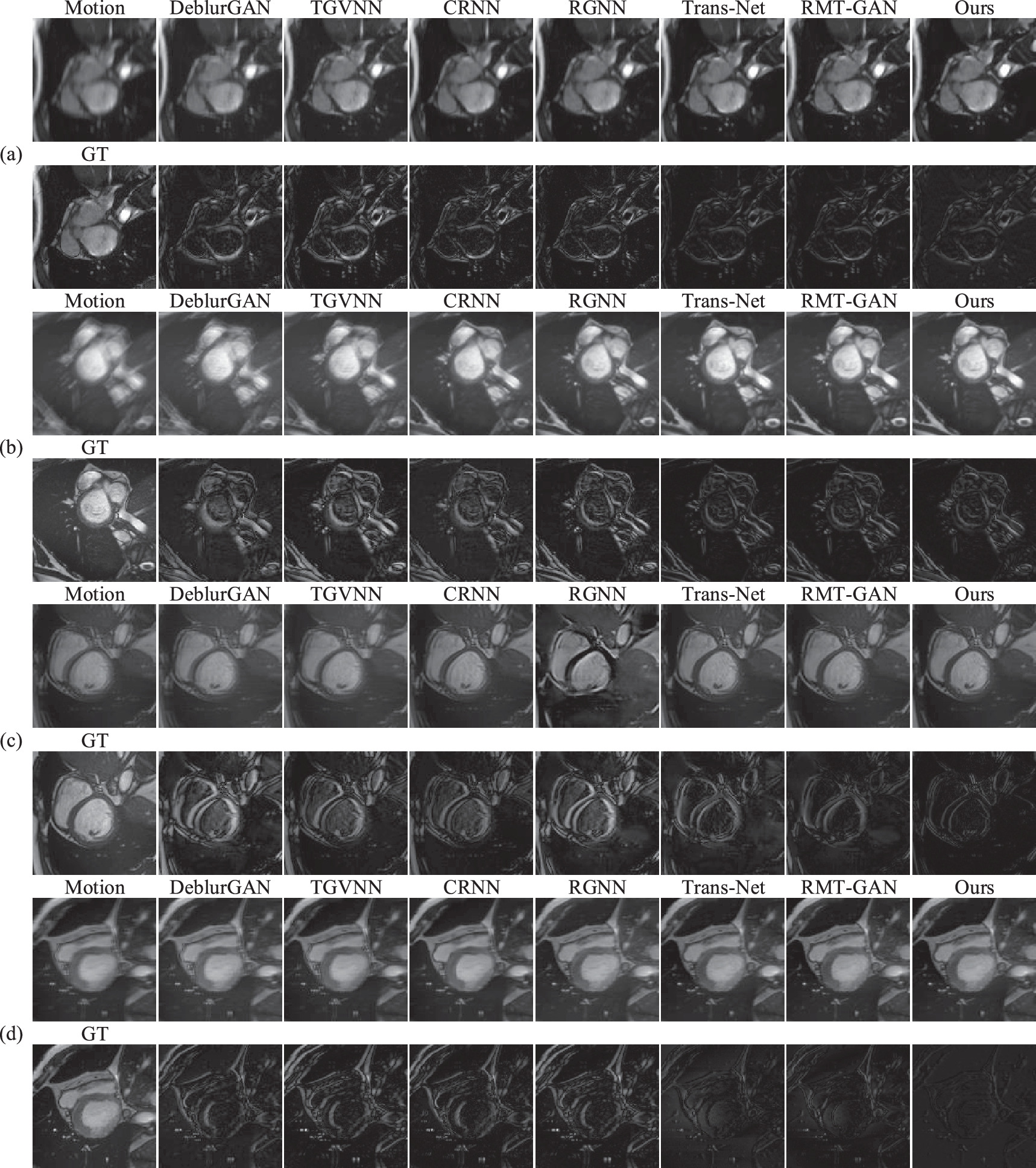 A cardiac MRI motion artifact reduction method based on edge ...