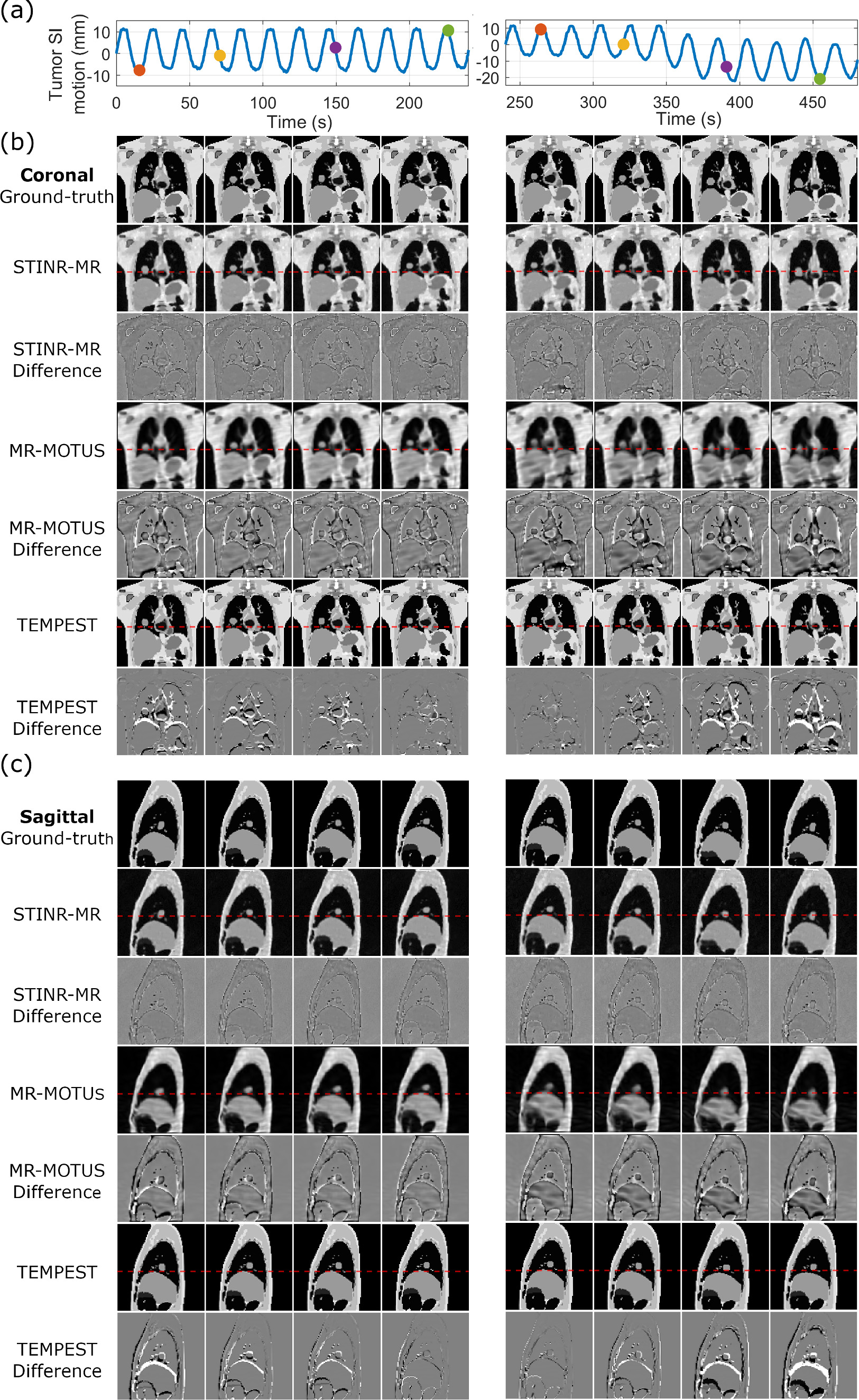 3D cine-magnetic resonance imaging using spatial and temporal implicit ...