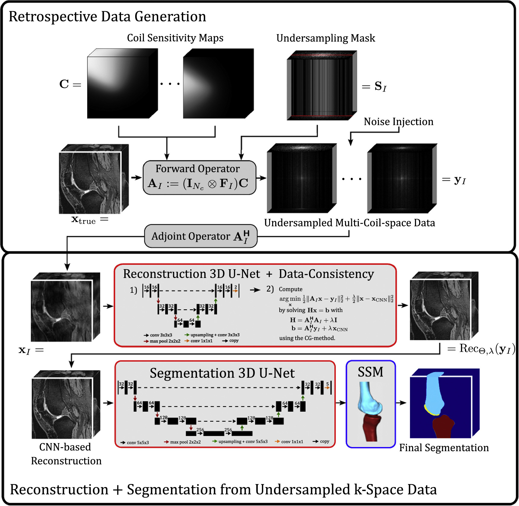 Joint reconstruction and segmentation in undersampled 3D knee MRI ...