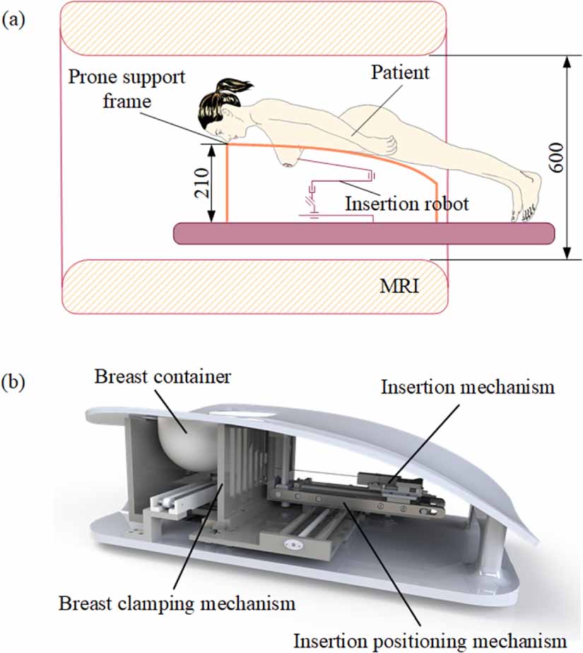 Path planning for flexible needle based on both insertion mechanism ...