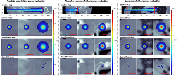 Lightweight and universal deep learning model for fast proton spot dose ...