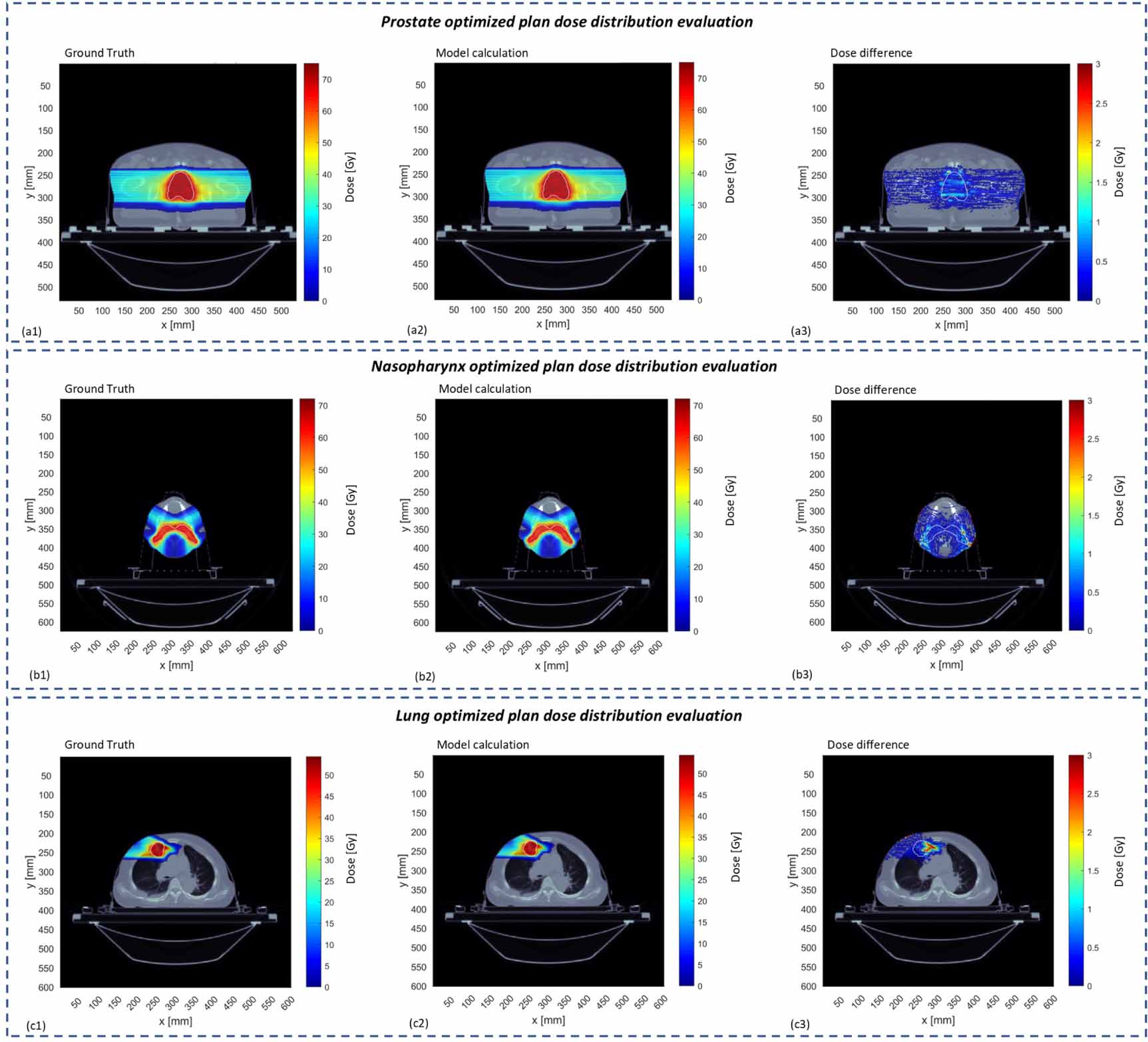 Lightweight and universal deep learning model for fast proton spot dose ...