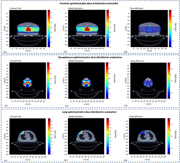 Lightweight and universal deep learning model for fast proton spot dose ...
