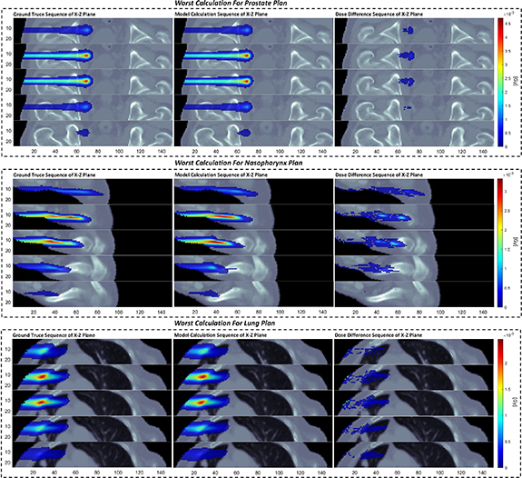 Lightweight and universal deep learning model for fast proton spot dose ...