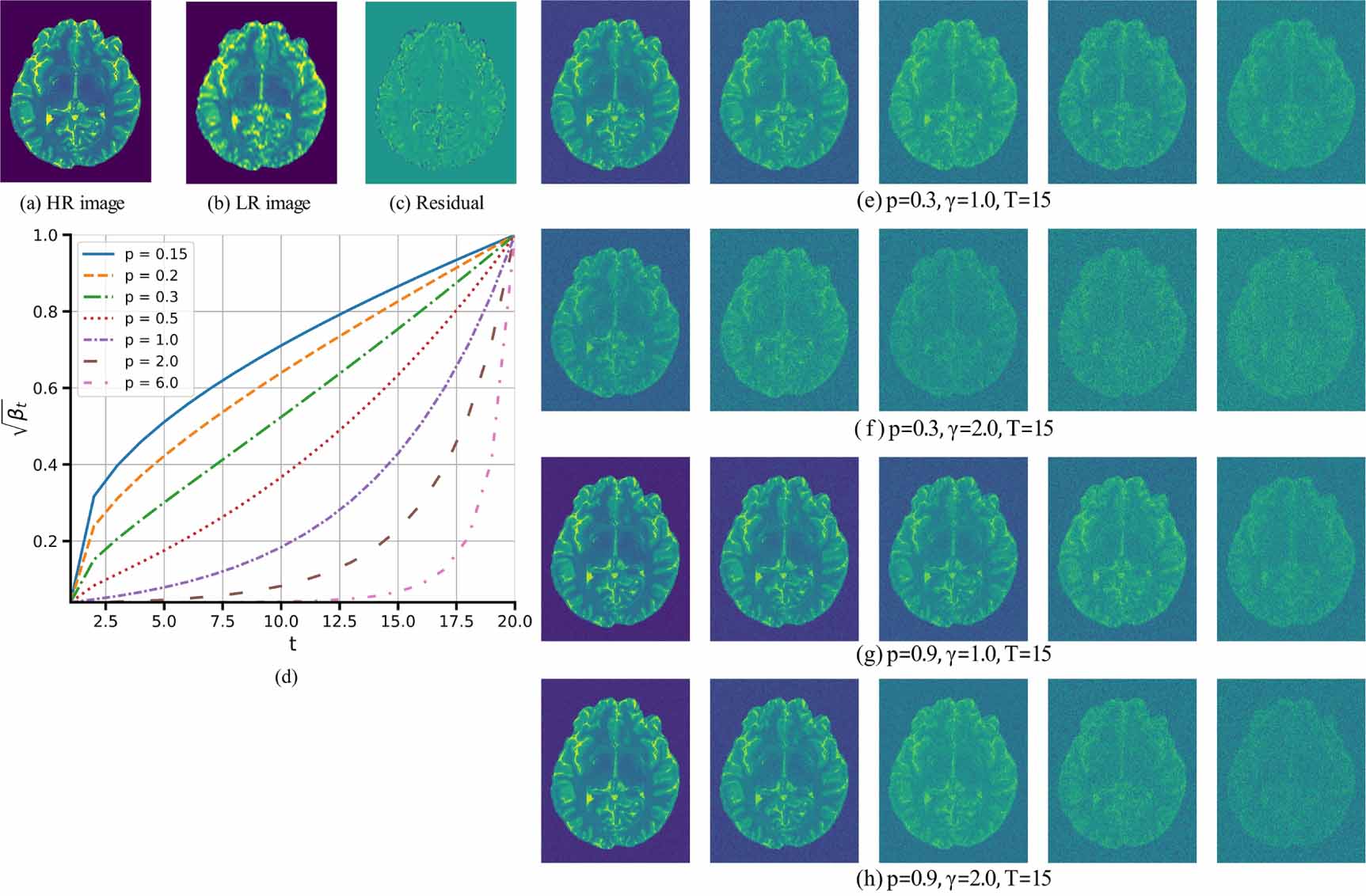 MRI super-resolution reconstruction using efficient diffusion ...
