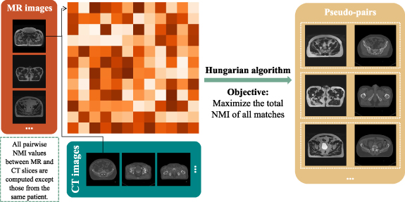 Mmd Algorithm Ct Quasi-supervised MR-CT image conversion based on unpaired data - IOPscience