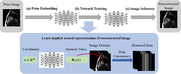 Implicit neural representation for medical image reconstruction ...