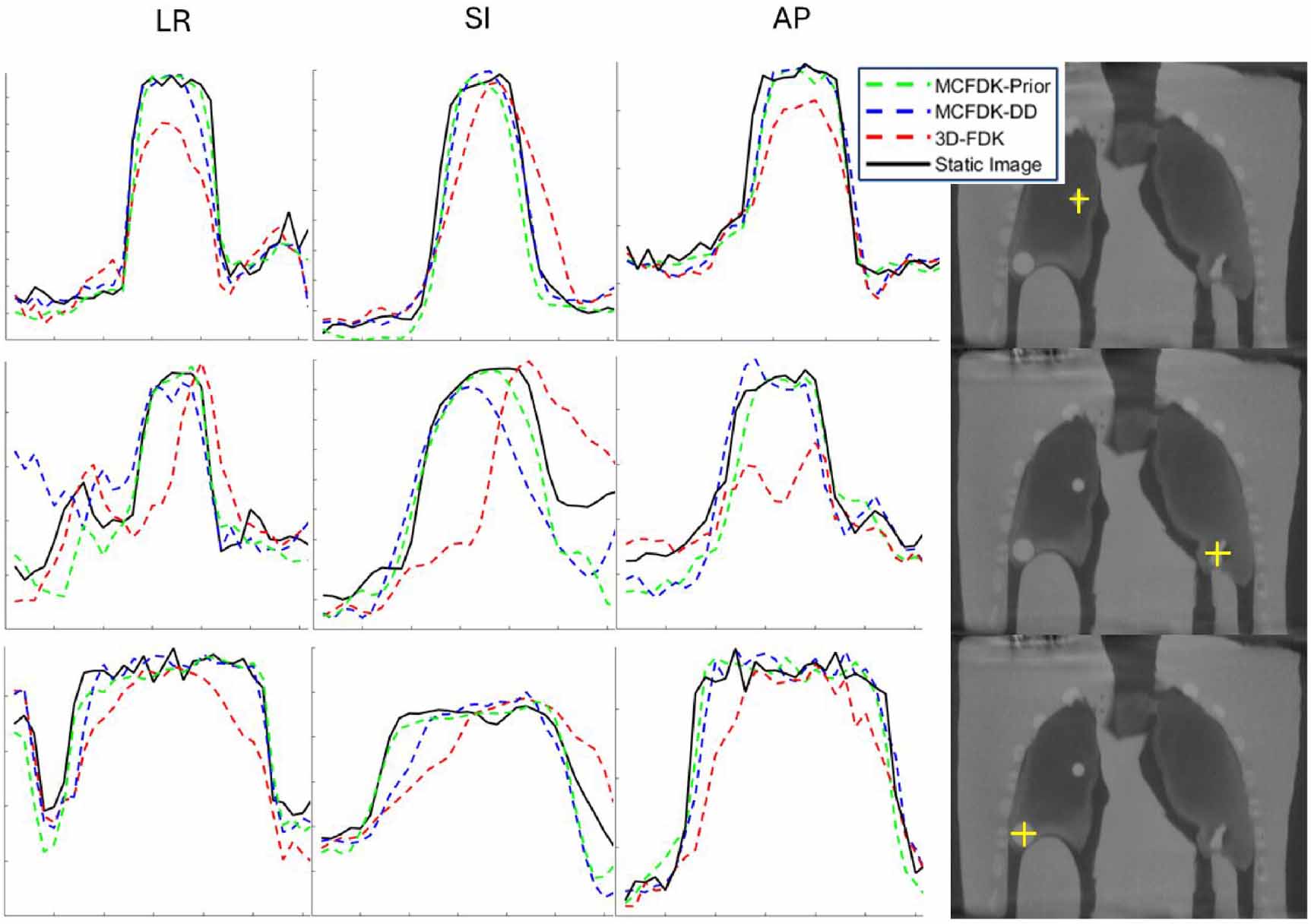 Evaluation of 4D cone-beam CT reconstruction methods for lung images ...