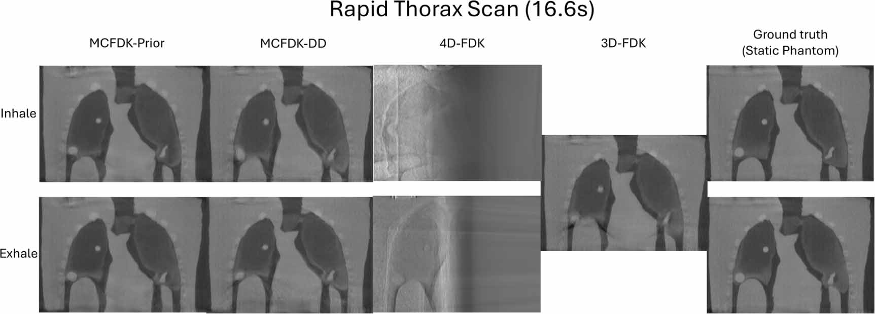 Evaluation of 4D cone-beam CT reconstruction methods for lung images ...