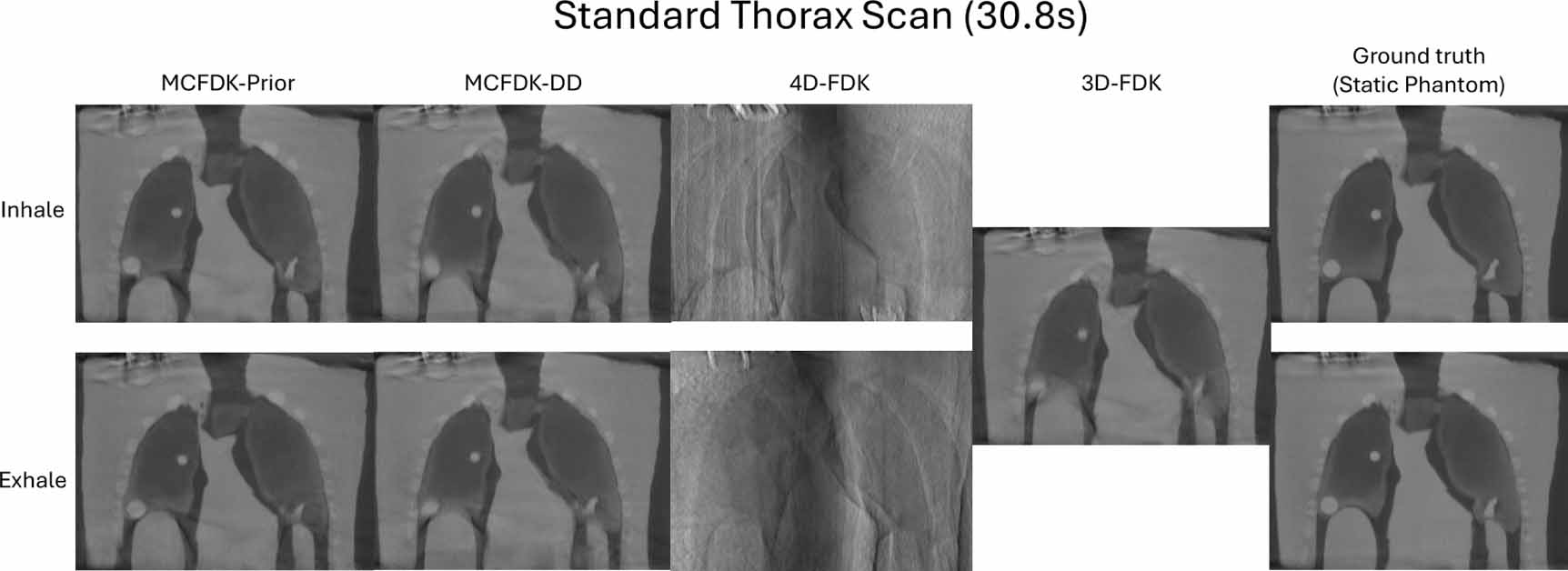 Evaluation of 4D cone-beam CT reconstruction methods for lung images ...