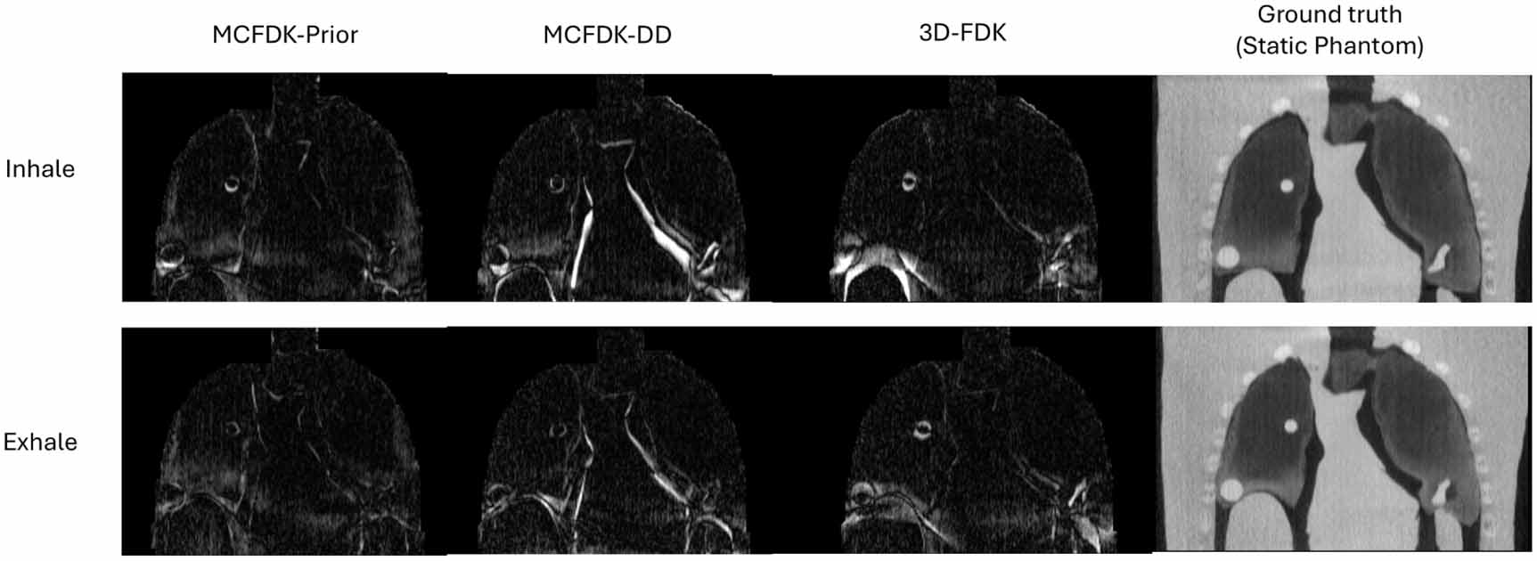 Evaluation of 4D cone-beam CT reconstruction methods for lung images ...