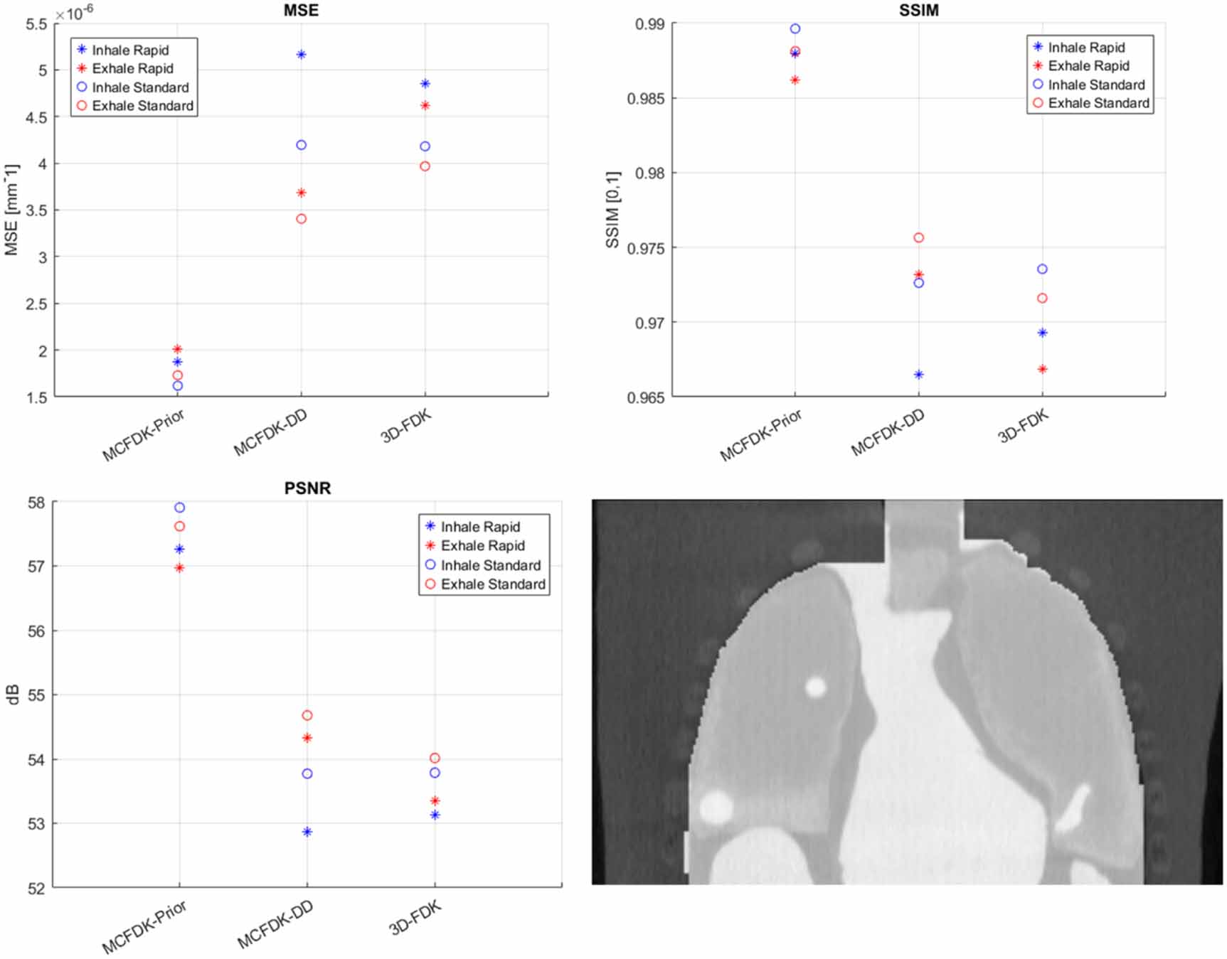 Evaluation of 4D cone-beam CT reconstruction methods for lung images ...