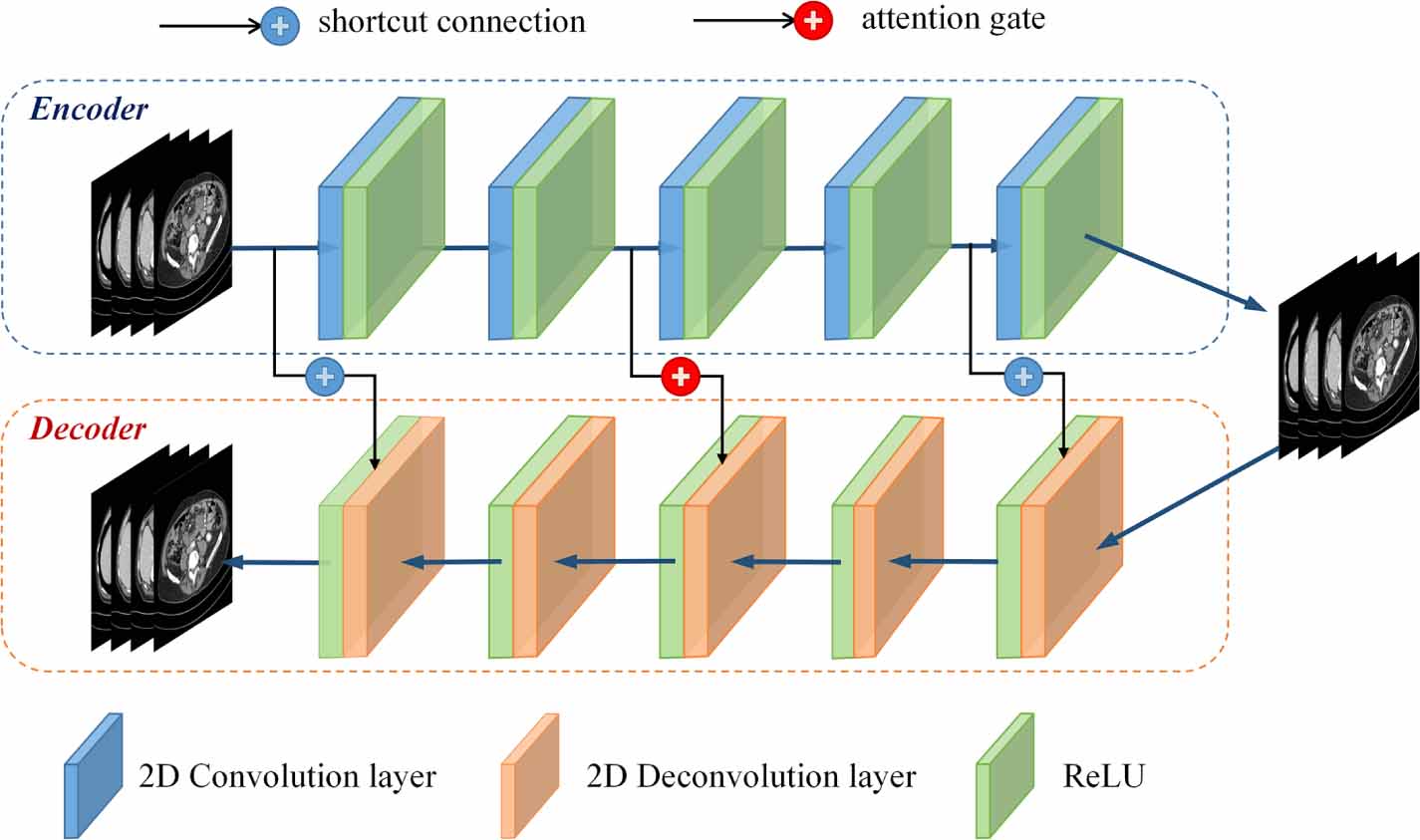 Self-supervised learning for low-dose CT image denoising method based ...