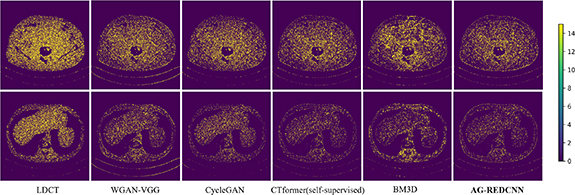 Self-supervised learning for low-dose CT image denoising method based ...