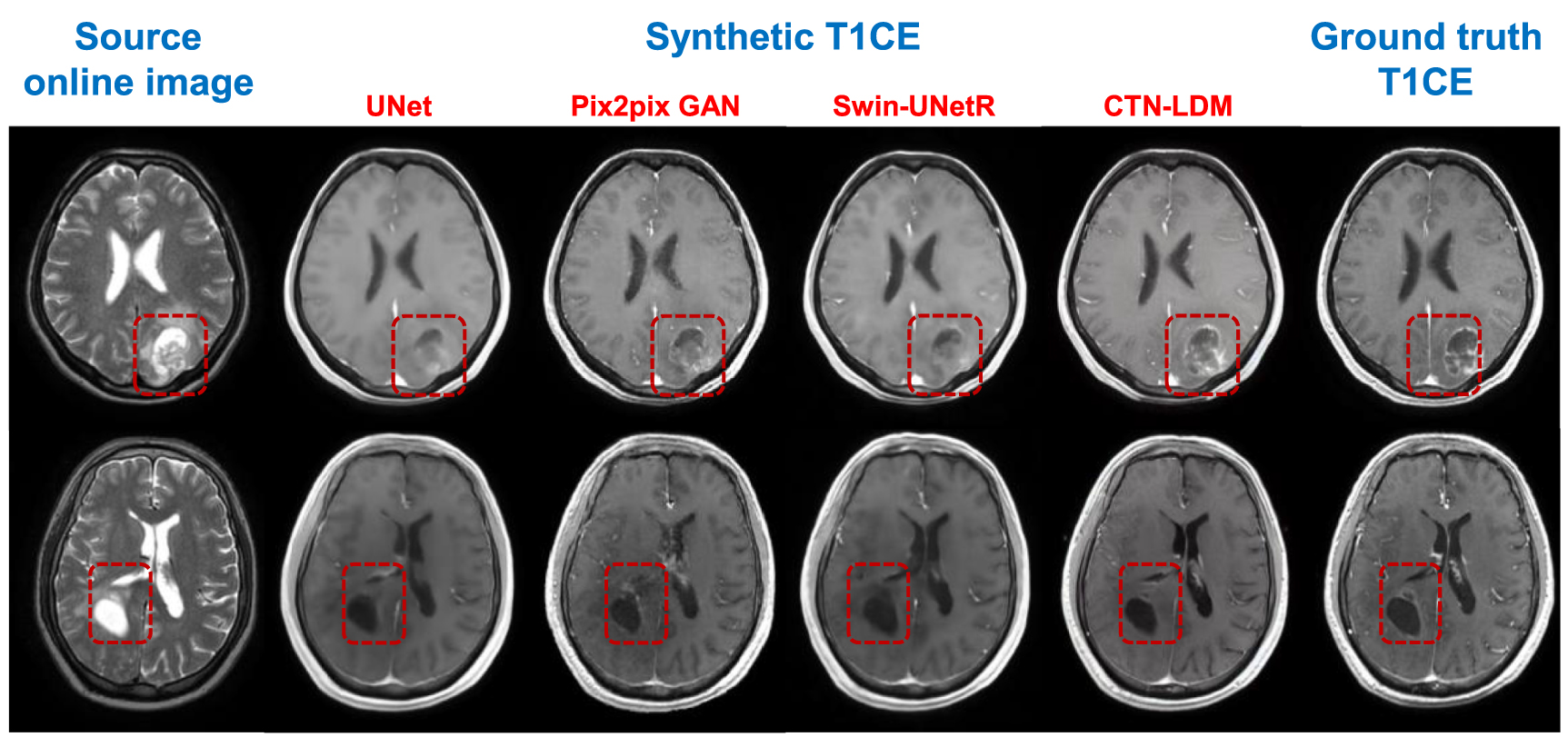 Contrast-enhanced image synthesis using latent diffusion model for ...