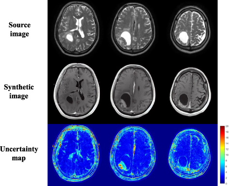 Contrast-enhanced image synthesis using latent diffusion model for ...