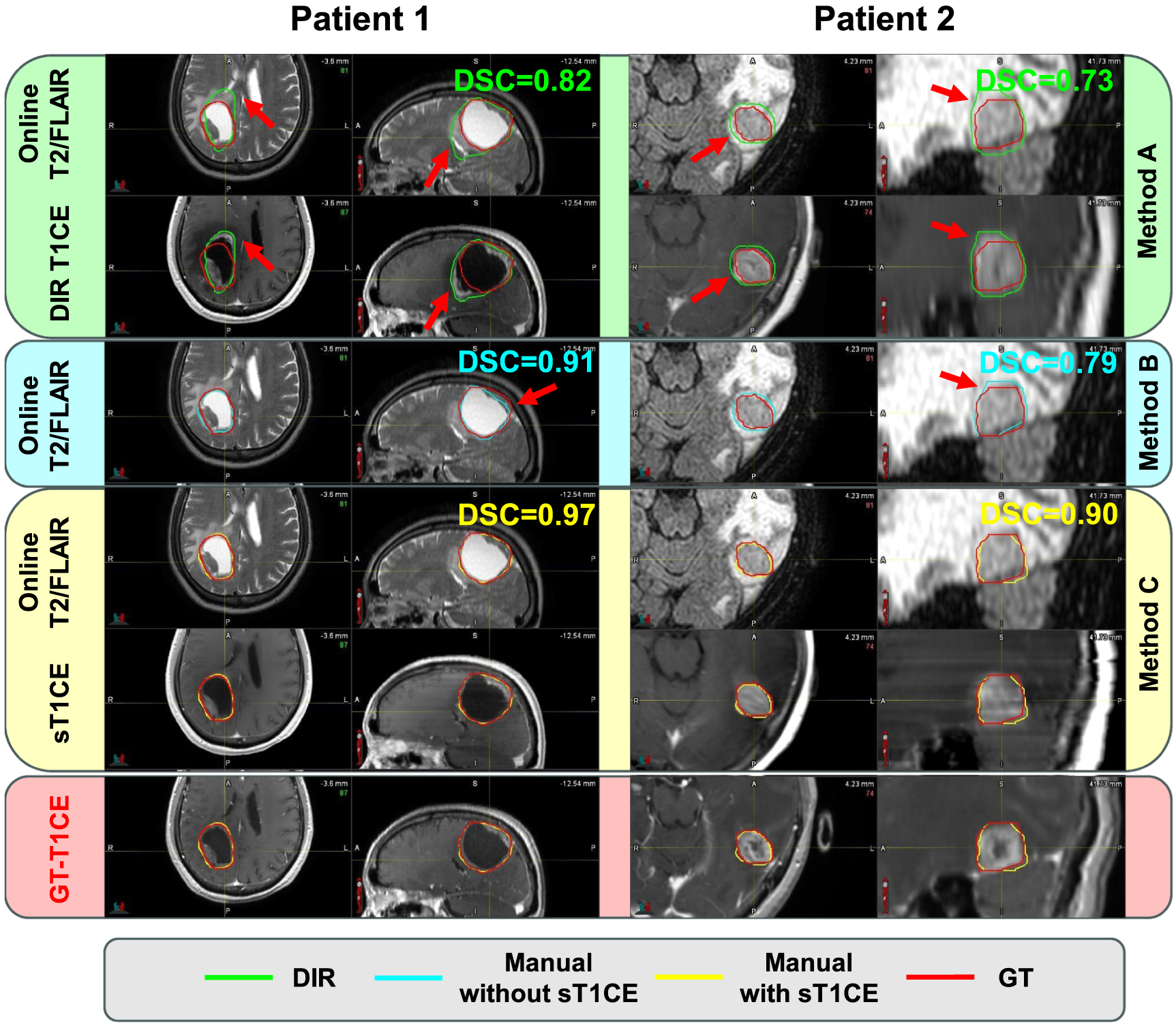 Contrast-enhanced image synthesis using latent diffusion model for ...